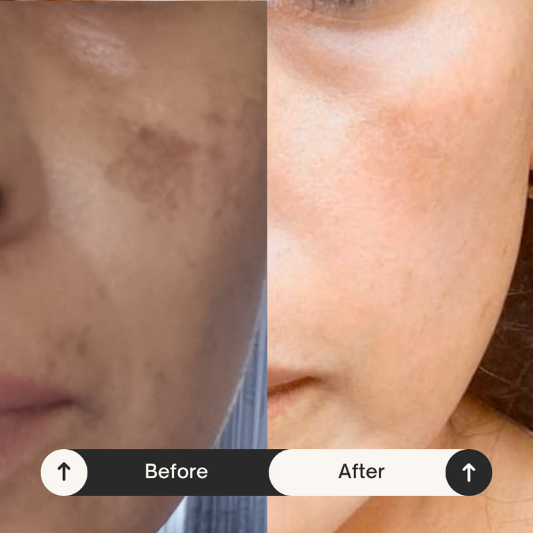 INTENSE PIGMENTATION & LIGHTENING CREAM